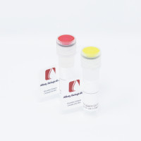 Factor XII Inhibitor Plasma, 1ml vial – (Mild) – Frozen (Special Terms Apply*)