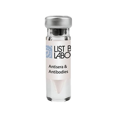 Anti-Botulinum Neurotoxin, Type A (Mouse lgG monoclonal F1-40), Liquid (Term 6)