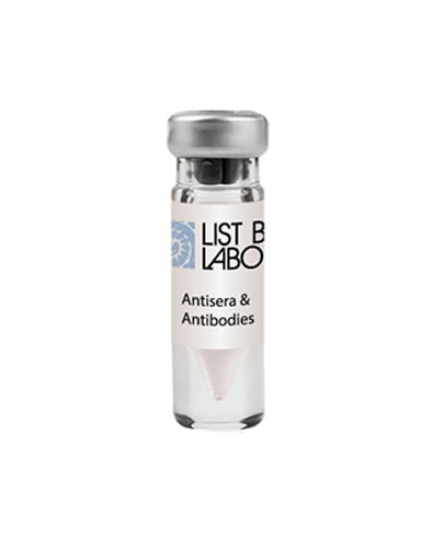 Anti-Botulinum Neurotoxin, Type A (Mouse lgG monoclonal F1-40), Liquid (Term 6)