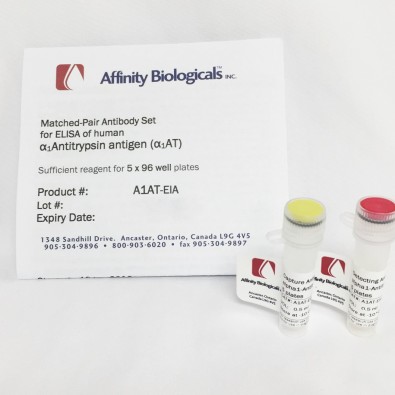 Alpha 1 Antitrypsin  – Paired Antibody Set for ELISA
