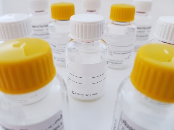 Anti-human Alpha 1 Antitrypsin, Matched Pair Antibodies for EIA