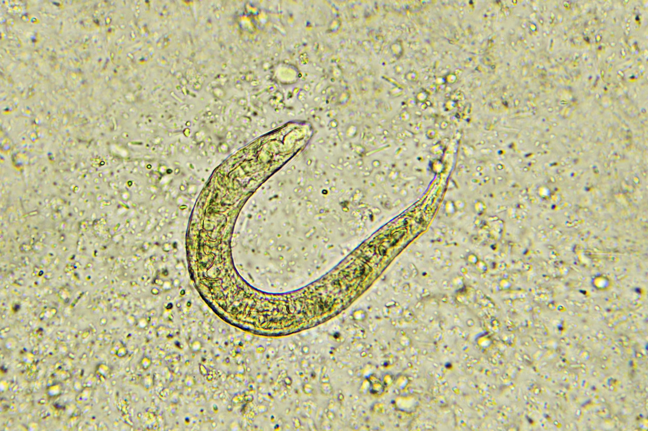 Strongyloides Ratti