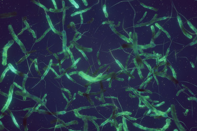 Cholera bacteria in a dark blue water